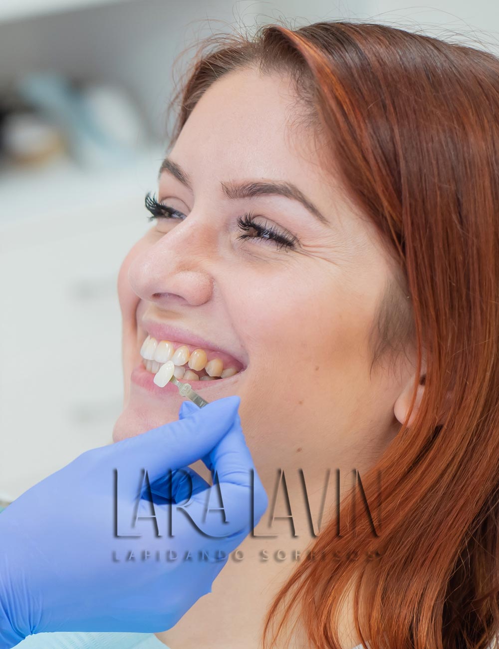 Facetas de Porcelana