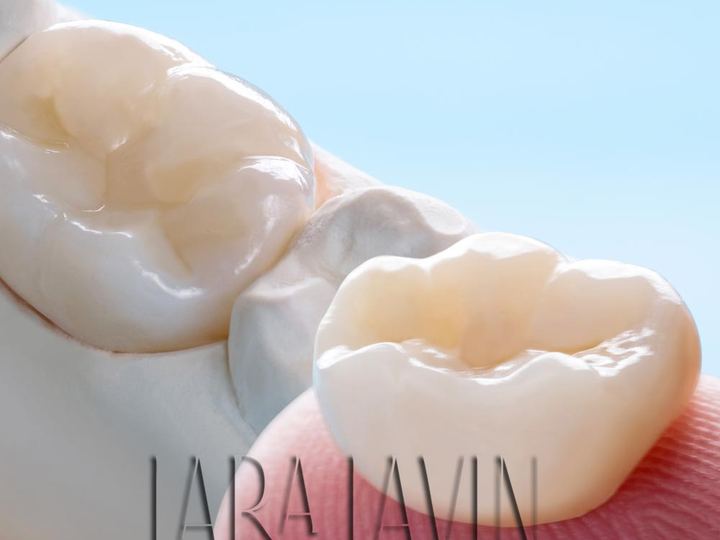 Coroa de Porcelana