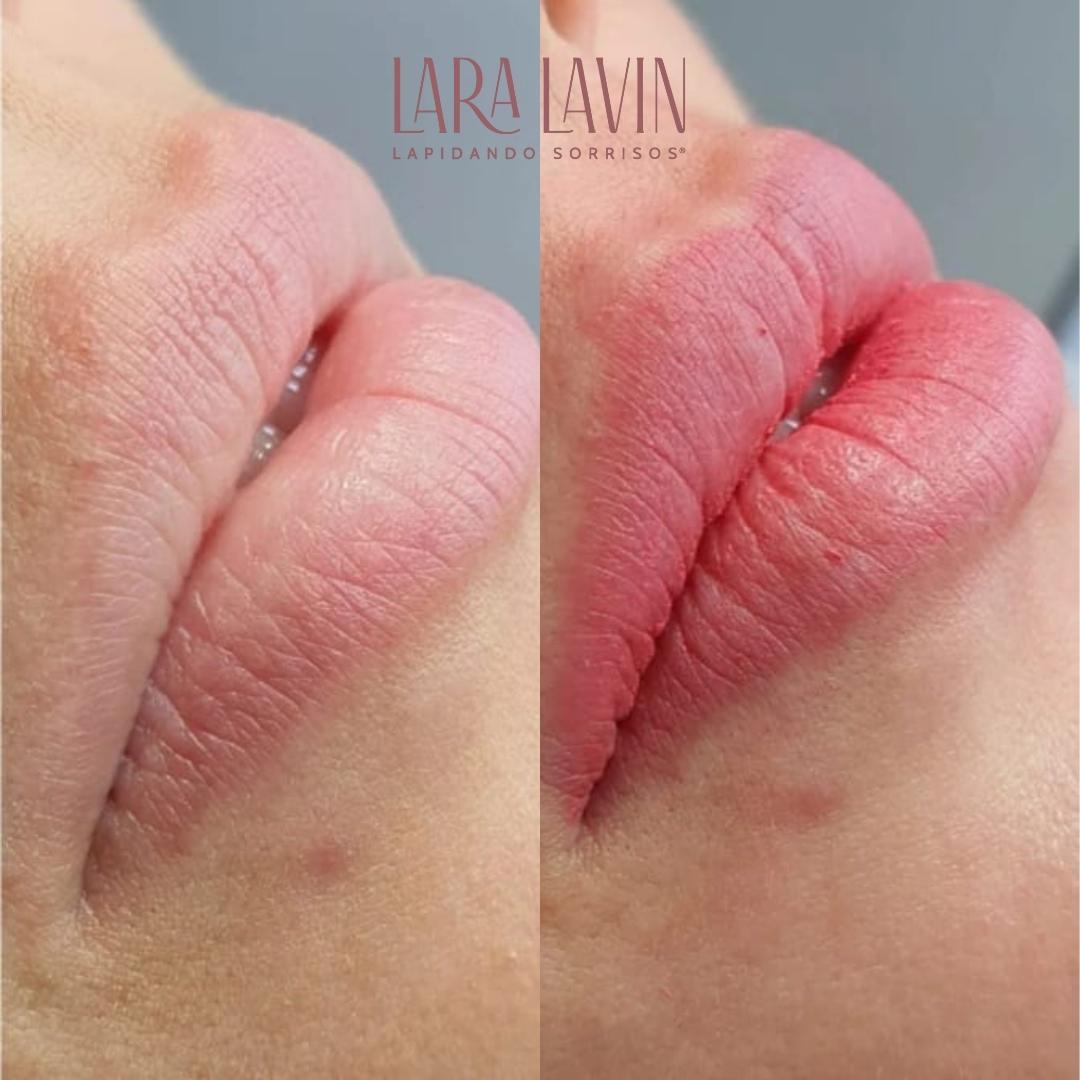 Dra. Lara Lavin Micropigmentação Labial #1.E