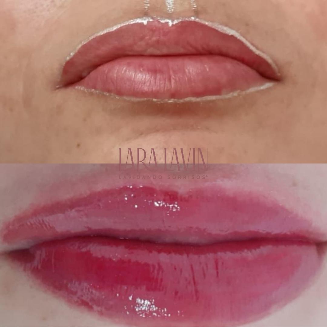 Dra. Lara Lavin Micropigmentação Labial #3.E