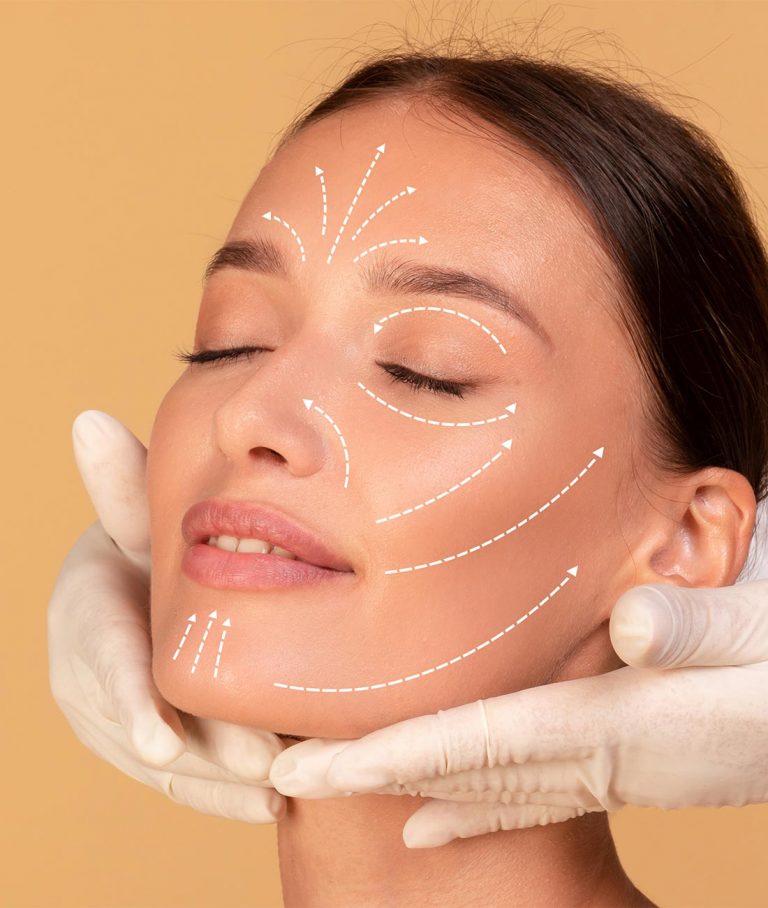 Bioestimuladores de Colágeno