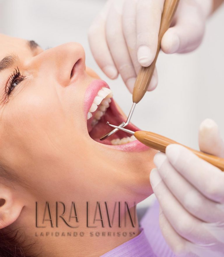 Extração de Dentes