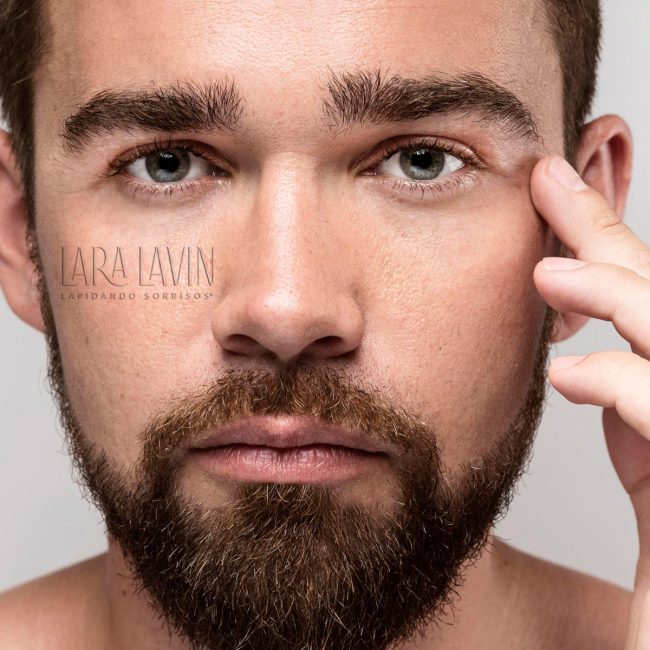Harmonização Facial Masculina