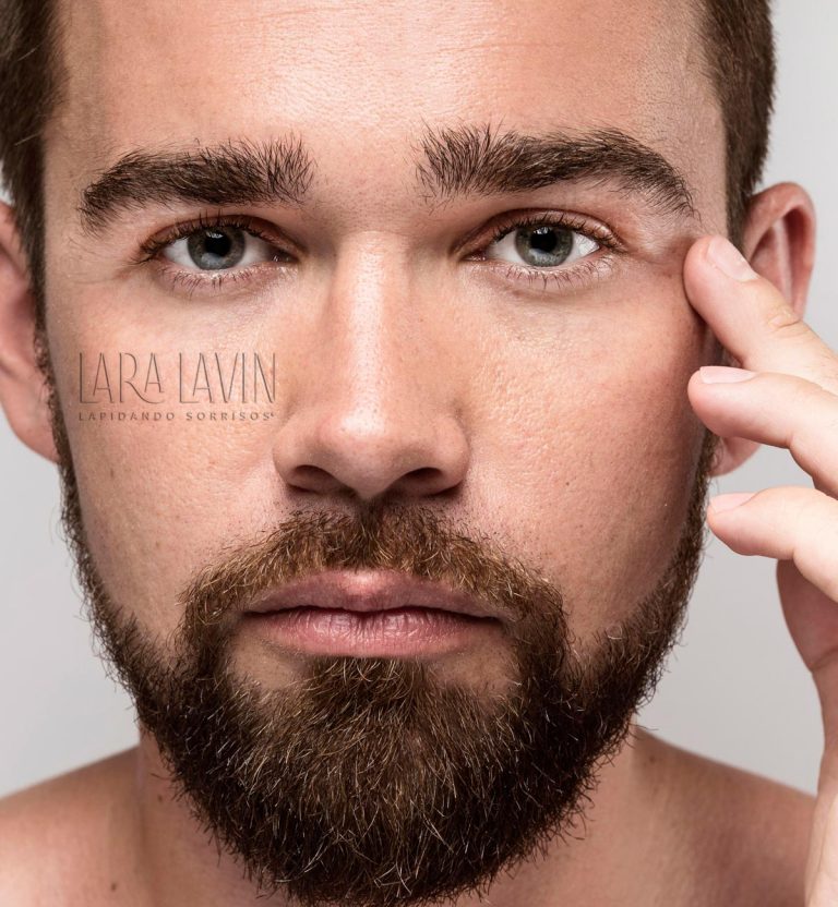 Harmonização Facial Masculina