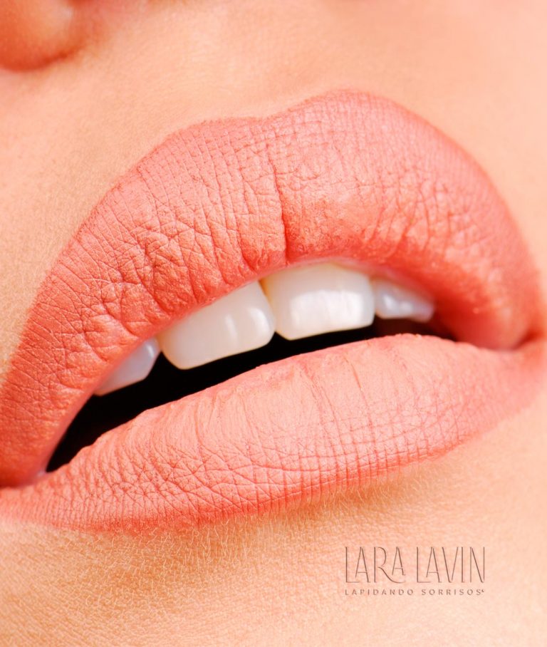 Preenchimento labial