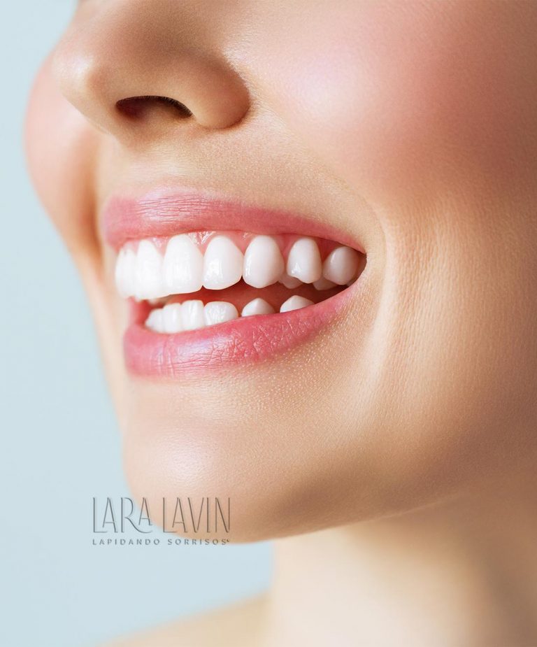 Lentes de contato dental