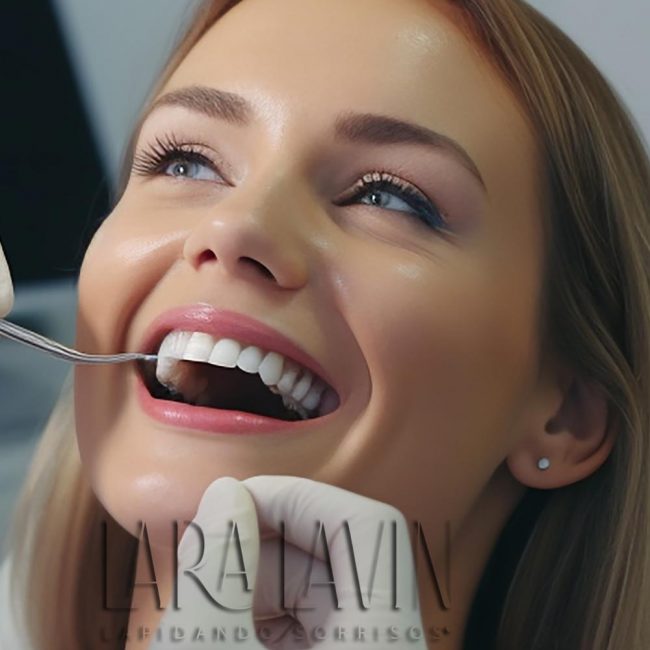 Facetas de Porcelana