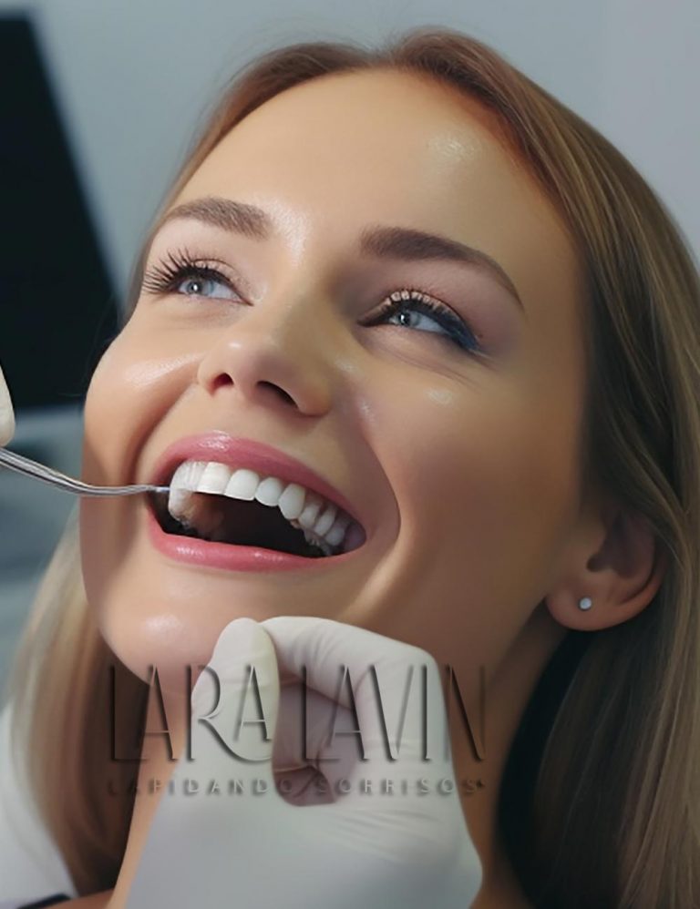 Facetas de Porcelana