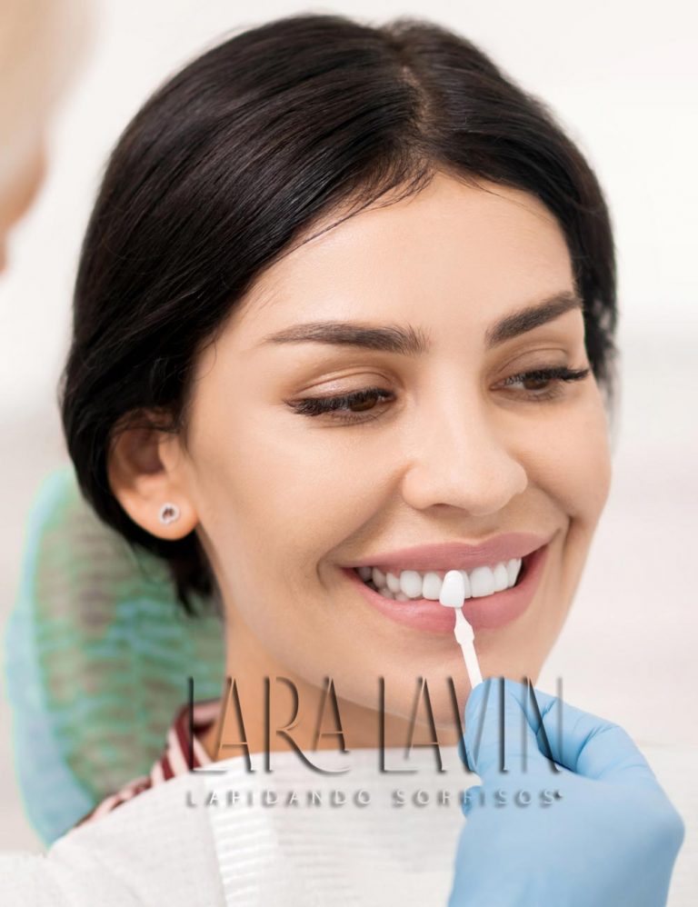 Facetas de Porcelana